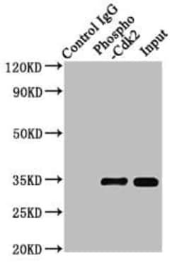 CDK2, p Tyr15 Antibody (2C4), Novus Biologicals:Antibodies:Primary Antibodies