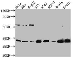PGAM1 Antibody (9A5), Novus Biologicals 100 &mu;L; Unconjugated:Antibodies,