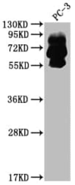 Proprotein Convertase 9/PCSK9 Antibody (7F2), Novus Biologicals 100 &mu;L;