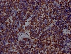 PARP Antibody (7C11), Novus Biologicals 100 &mu;L; Unconjugated:Antibodies,