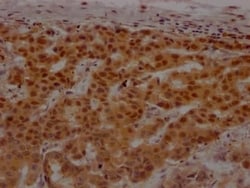 PARP Antibody (8C7), Novus Biologicals:Antibodies:Primary Antibodies