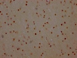 PARP Antibody (8C7), Novus Biologicals:Antibodies:Primary Antibodies