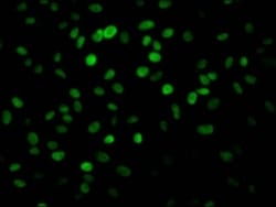 PARP Antibody (8C7), Novus Biologicals:Antibodies:Primary Antibodies