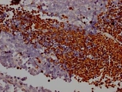 PARP Antibody (5H8), Novus Biologicals:Antibodies:Primary Antibodies