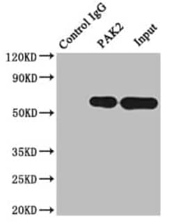 PAK2 Antibody (6D12), Novus Biologicals 50 &mu;L; Unconjugated:Antibodies,