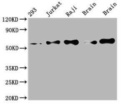 PAK2 Antibody (6D12), Novus Biologicals 50 &mu;L; Unconjugated:Antibodies,