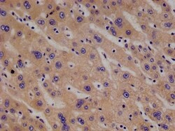 Phenylalanine Hydroxylase Antibody (17D10), Novus Biologicals 50 &mu;L;