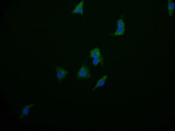 Phenylalanine Hydroxylase Antibody (17D10), Novus Biologicals 50 &mu;L;