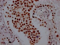 PABPN1 Antibody (6C3), Novus Biologicals:Antibodies:Primary Antibodies