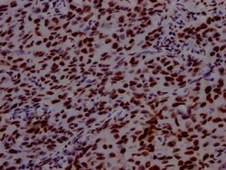PABPN1 Antibody (6C3), Novus Biologicals:Antibodies:Primary Antibodies