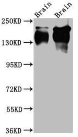 TrkA Antibody (2A5), Novus Biologicals:Antibodies:Primary Antibodies