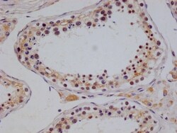 NTH1 Antibody (22H10), Novus Biologicals:Antibodies:Primary Antibodies