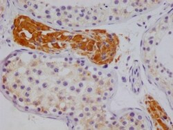 NSDHL Antibody (20F2), Novus Biologicals 100 &mu;L; Unconjugated:Antibodies,