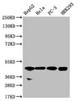 NSDHL Antibody (20F2), Novus Biologicals 100 &mu;L; Unconjugated:Antibodies,