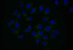 NPRB/NPR2 Antibody (19C7), Novus Biologicals 100 &mu;L; Unconjugated:Antibodies,