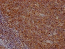 Caspase-3 Antibody (6B2) - Pro, Novus Biologicals:Antibodies:Primary Antibodies