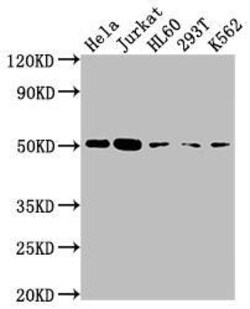 Caspase-2 Antibody (7E5), Novus Biologicals:Antibodies:Primary Antibodies