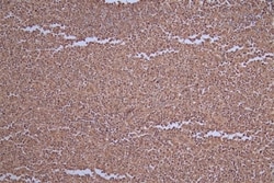 Carbonic Anhydrase I/CA1 Antibody (26E3), Novus Biologicals:Antibodies:Primary