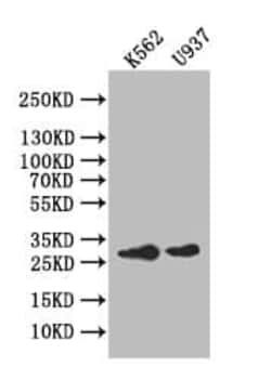 Carbonic Anhydrase I/CA1 Antibody (26E3), Novus Biologicals:Antibodies:Primary