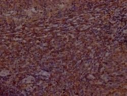 BTK Antibody (3E5), Novus Biologicals:Antibodies:Primary Antibodies