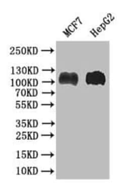 BRIP1/FANCJ Antibody (27F4), Novus Biologicals:Antibodies:Primary Antibodies