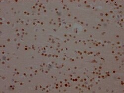 BRD4 Antibody (1E5), Novus Biologicals:Antibodies:Primary Antibodies