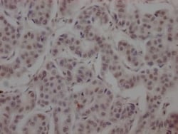 BRD4 Antibody (1E5), Novus Biologicals:Antibodies:Primary Antibodies