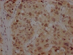 BMI-1 Antibody (1F2), Novus Biologicals 50 &mu;L; Unconjugated:Antibodies,