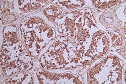 Bcl-6 Antibody (6E3), Novus Biologicals:Antibodies:Primary Antibodies