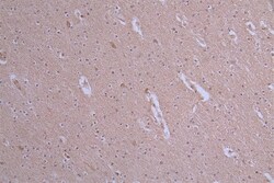 ATP7b Antibody (36D12), Novus Biologicals 100 &mu;L; Unconjugated:Antibodies,