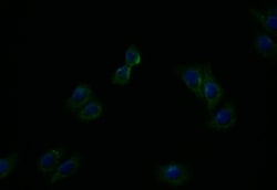ATP7b Antibody (36D12), Novus Biologicals 100 &mu;L; Unconjugated:Antibodies,