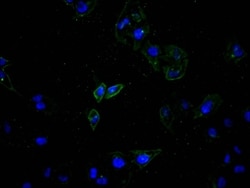 ATP7b Antibody (9H8), Novus Biologicals 50 &mu;L; Unconjugated:Antibodies,