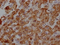 ATPB Antibody (5F10), Novus Biologicals 100 &mu;L; Unconjugated:Antibodies,