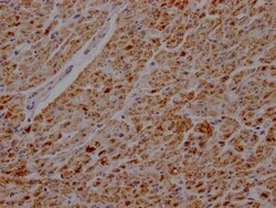 ATPB Antibody (5F10), Novus Biologicals 100 &mu;L; Unconjugated:Antibodies,