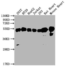 ATPB Antibody (5F10), Novus Biologicals 100 &mu;L; Unconjugated:Antibodies,