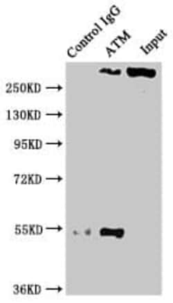 ATM Antibody (4E11), Novus Biologicals 100 &mu;L; Unconjugated:Antibodies,