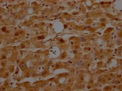 ATF5 Antibody (9D8), Novus Biologicals 50 &mu;L | Buy Online | Novus Biologicals | Fisher Scientific