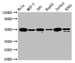 ATF4 Antibody (9E1), Novus Biologicals 50 &mu;L; Unconjugated:Antibodies,