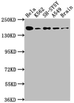 APC Antibody (5F2), Novus Biologicals 100 &mu;L; Unconjugated:Antibodies,