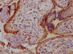 Angiopoietin-2 Antibody (1F10), Novus Biologicals:Antibodies:Primary Antibodies