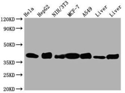 Aldolase A Antibody (7D8), Novus Biologicals 100 &mu;L; Unconjugated:Antibodies,