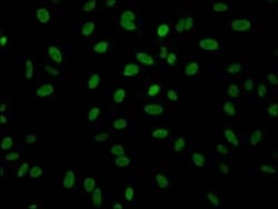 Aldolase A Antibody (7D8), Novus Biologicals 100 &mu;L; Unconjugated:Antibodies,