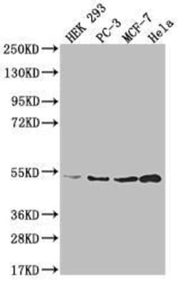 Adenosylhomocysteinase/AHCY Antibody (13H8), Novus Biologicals:Antibodies:Primary