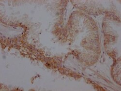 beta-2 Adrenergic R/ADRB2 Antibody (4C11), Novus Biologicals:Antibodies:Primary