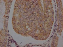 beta-2 Adrenergic R/ADRB2 Antibody (4C11), Novus Biologicals:Antibodies:Primary