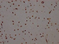 ADAR Antibody (7H12), Novus Biologicals 50 &mu;L | Buy Online | Novus Biologicals | Fisher Scientific