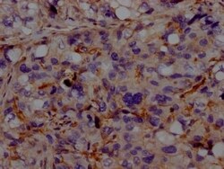 ALK-1 Antibody (8B6), Novus Biologicals 50 &mu;L; Unconjugated:Antibodies,