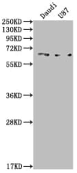 ALK-1 Antibody (8B6), Novus Biologicals 50 &mu;L; Unconjugated:Antibodies,