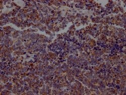 Aconitase 2 Antibody (8H4), Novus Biologicals:Antibodies:Primary Antibodies