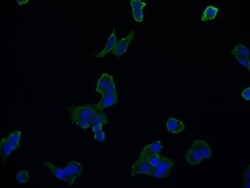 Aconitase 1 Antibody (22C10), Novus Biologicals 100 μL; Unconjugated:Antibodies,